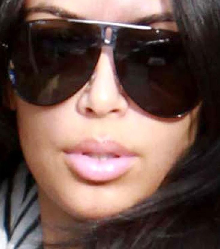 kim kardashian plastic surgery lips. KK and her new lips.