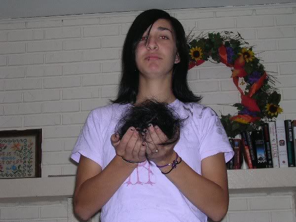 hair photo:hair loss treatments 